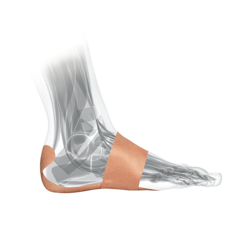 ΤΑΙΝΙΑ PRE-CUT ΠΕΛΜΑΤΙΑΙΑΣ ΑΠΟΝΕΥΡΩΣΙΤΙΔΑΣ PFTAPE MUELLER 7ΤΜΧ Mueller ΤΑΙΝΙΑ PRE-CUT ΠΕΛΜΑΤΙΑΙΑΣ ΑΠΟΝΕΥΡΩΣΙΤΙΔΑΣ PFTAPE MUELLER 7ΤΜΧ Mueller